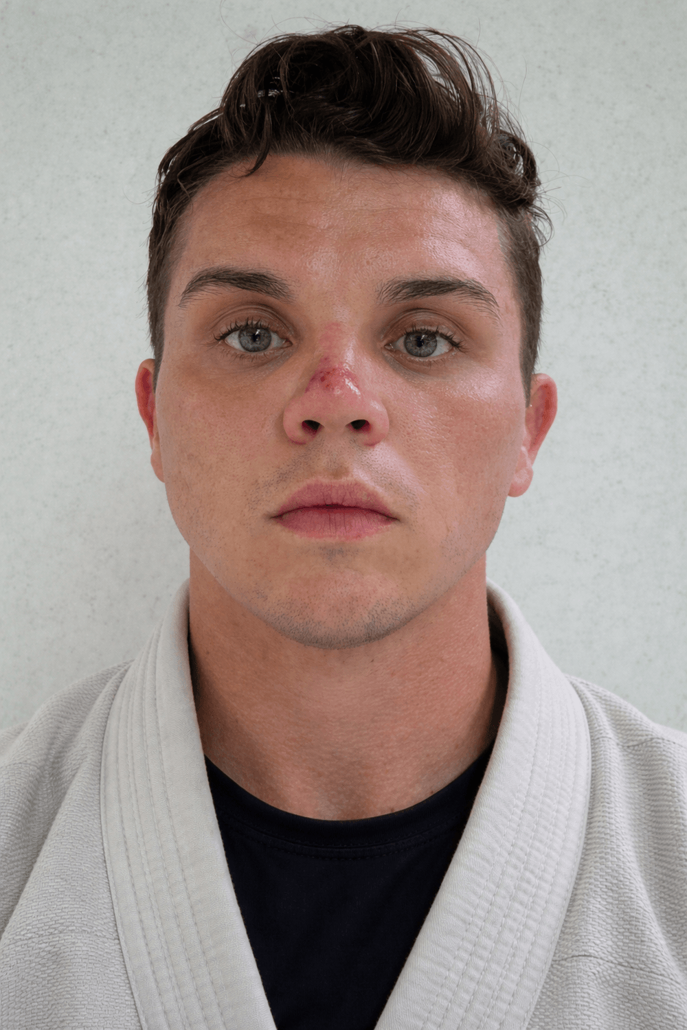 Person wearing a white BJJ martial arts uniform against a plain background with a skin infecton on their nose. 